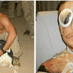 A brave Marine protected a friend by jumping on a grenade and was awarded the Medal of Honor.