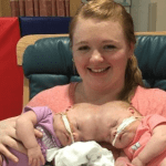 Exploring the Post-2017 Journey and Transformation of Separated Siamese Twins