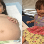 A young girl undergoes a life-saving kidney surgery, made possible by the generosity of her father.