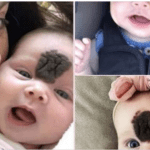 Parents hid their baby to keep her safe from people staring. Now, at 2 years old, she looks lovely.