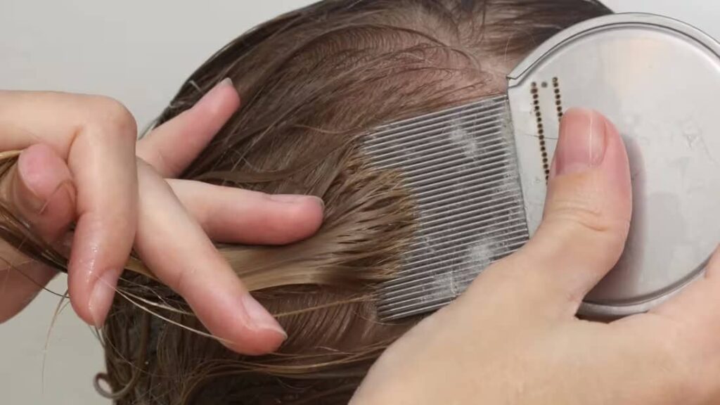 How to Get Rid of Head Lice and Keep Them Away